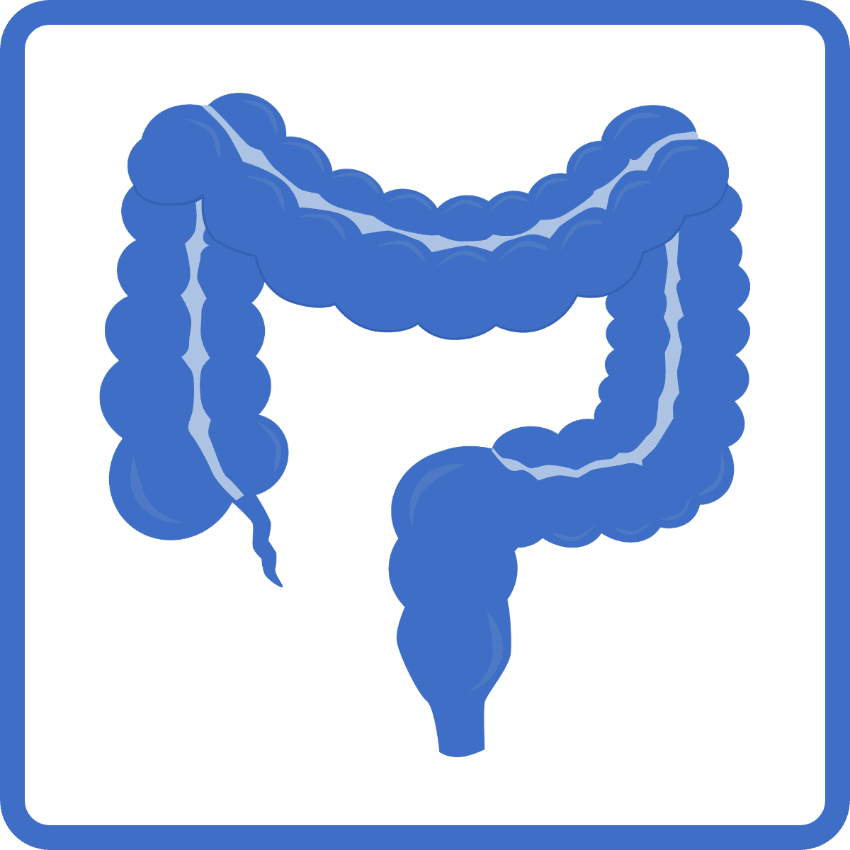 brusano image link to Cancer colorectal